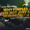 Acne in Ayurveda: Why Pimples Are Not Just a Skin Problem — Causes, Symptoms & Healing