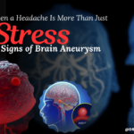 When a Headache Is More Than Just Stress: Signs of Brain Aneurysm
