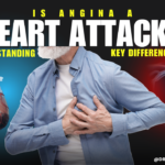 Is Angina a Heart Attack? Understanding the Key Differences