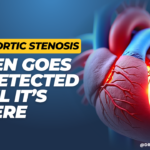 Why Aortic Stenosis Often Goes Undetected Until It’s Severe