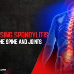 How Ankylosing Spondylitis Affects the Spine and Joints