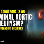 How Dangerous Is an Abdominal Aortic Aneurysm? Understanding the Risks