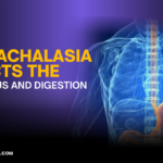How Achalasia Affects the Esophagus and Digestion