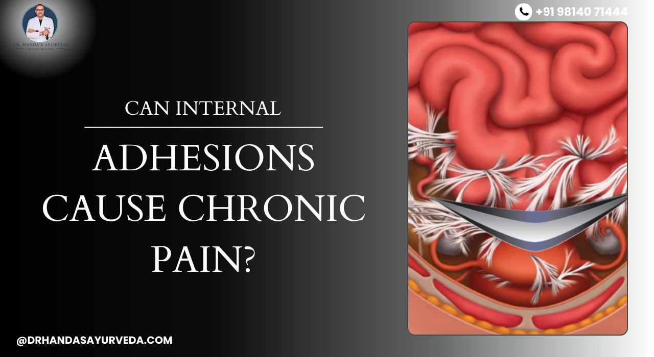 Can Internal Adhesions Cause Chronic Pain?