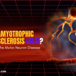 What Is Amyotrophic Lateral Sclerosis (ALS)? Understanding the Motor Neuron Disease