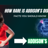 How Rare Is Addison’s Disease? Facts You Should Know